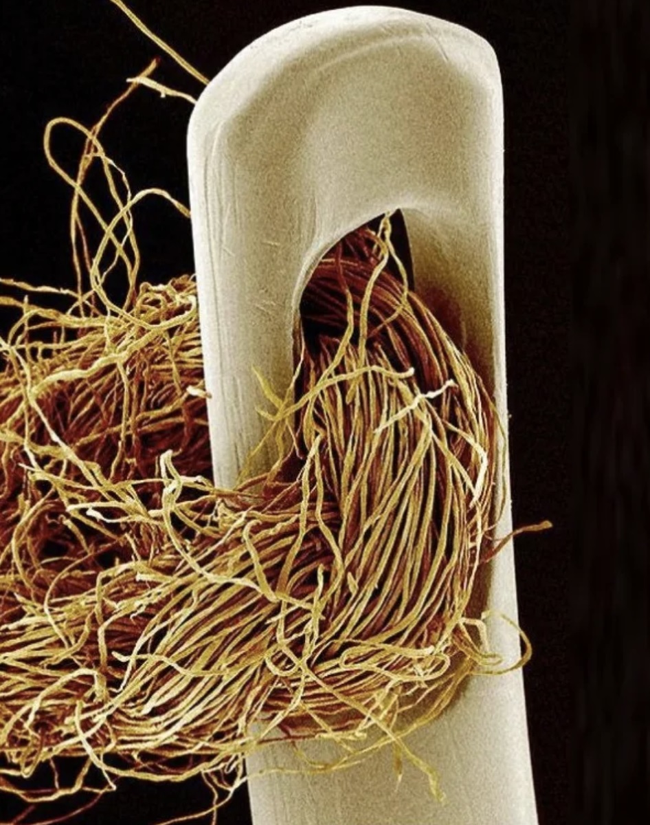 golden thread - electron microscope